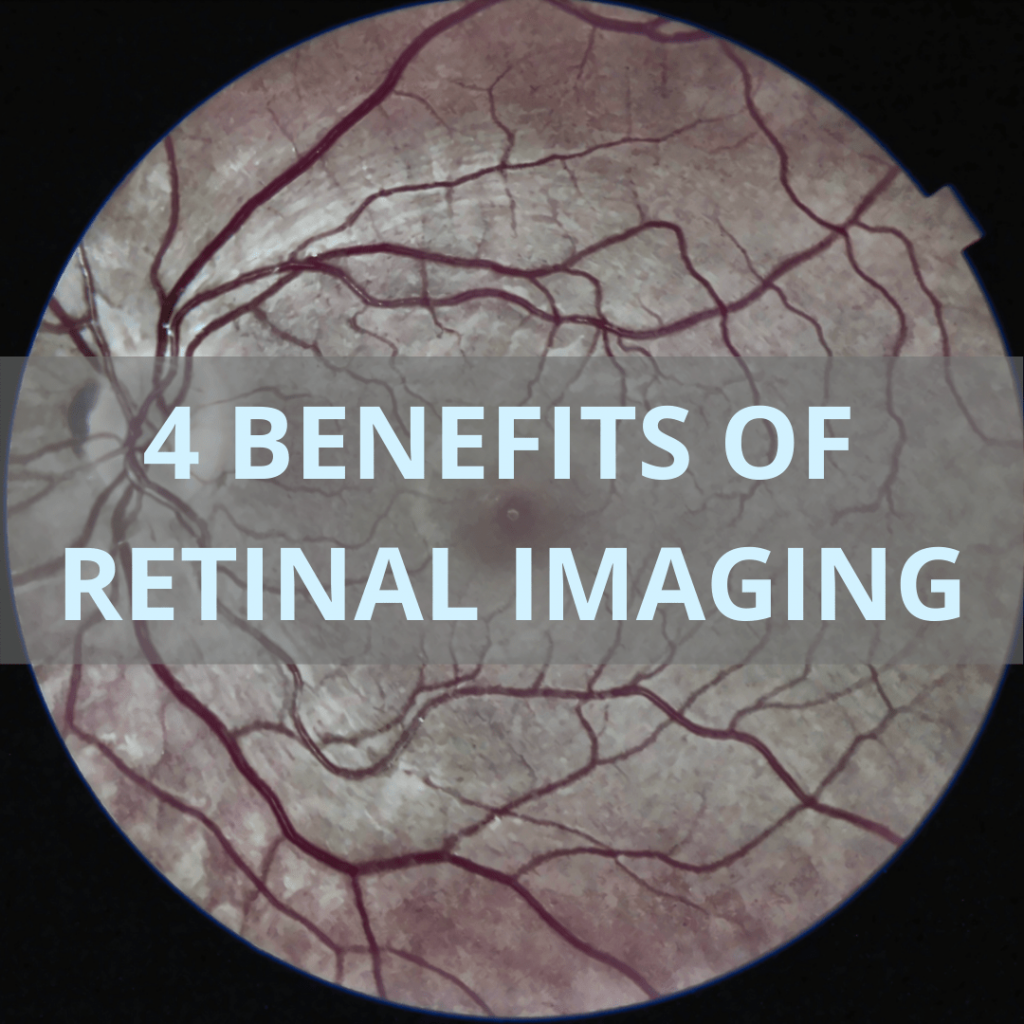 retinal imaging benefits